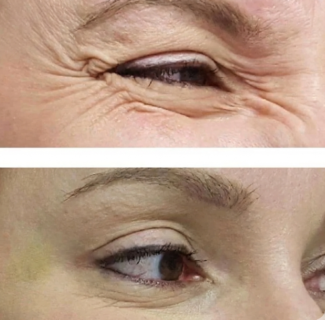 Sérum Super Renovador e Hidratante